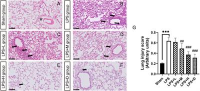 STC3141 improves acute lung injury through neutralizing circulating histone in rat with experimentally-induced acute respiratory distress syndrome